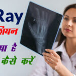 X-Ray-Technician-Course-job-salary-syllabus-college-Details-in-Hindi